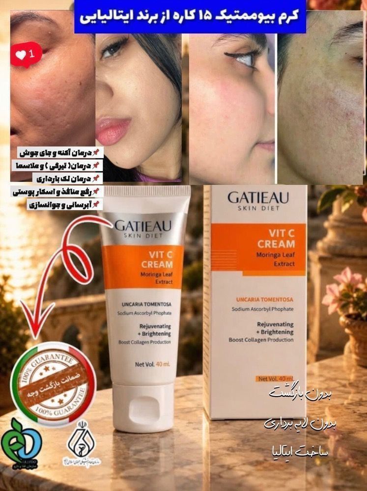 کرم بیوممتیک روشن کننده و ضدلک